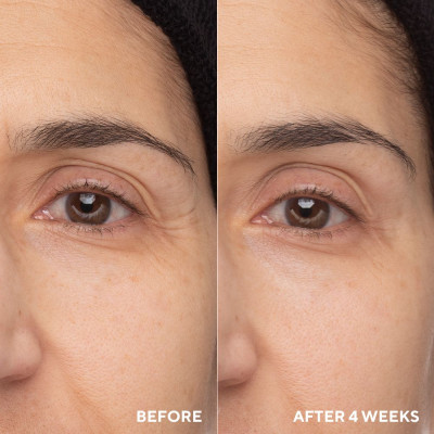 Retinol Eye Renewal