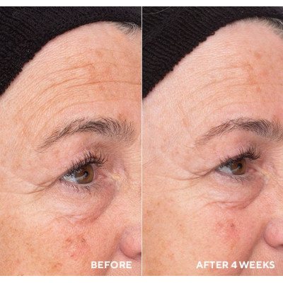 Liquid Resurfacing Solution