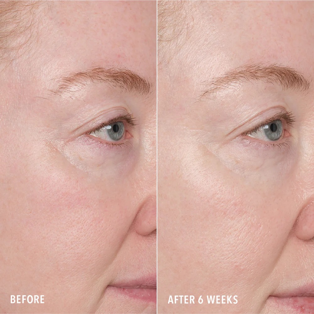 RESURFACE AND REPAIR PEPTIDE PADS