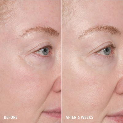 RESURFACE AND REPAIR PEPTIDE PADS